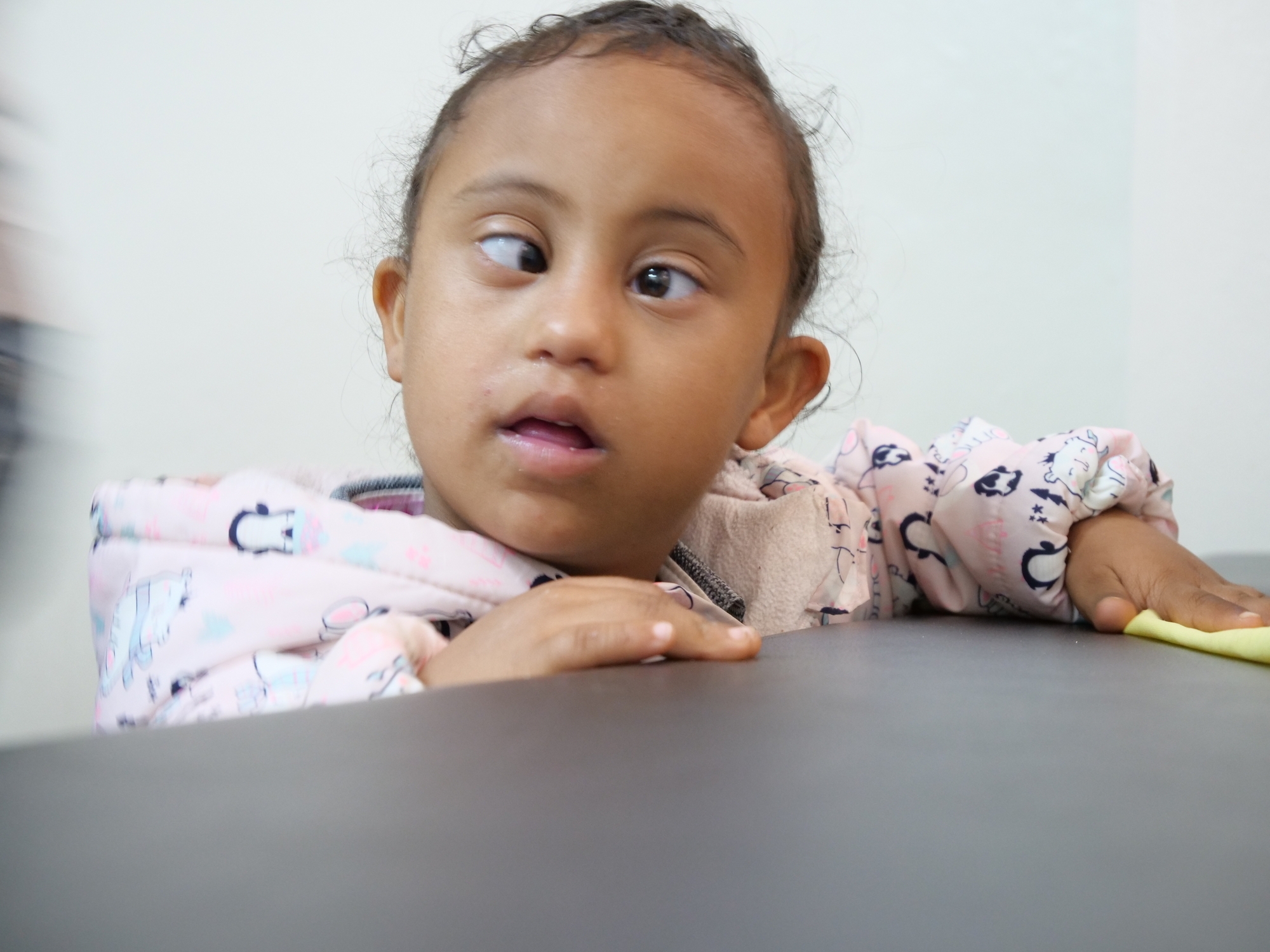 5-year-old Heran Tsega received surgery for strabismus 5-year-old Heran Tsega received surgery for strabismus