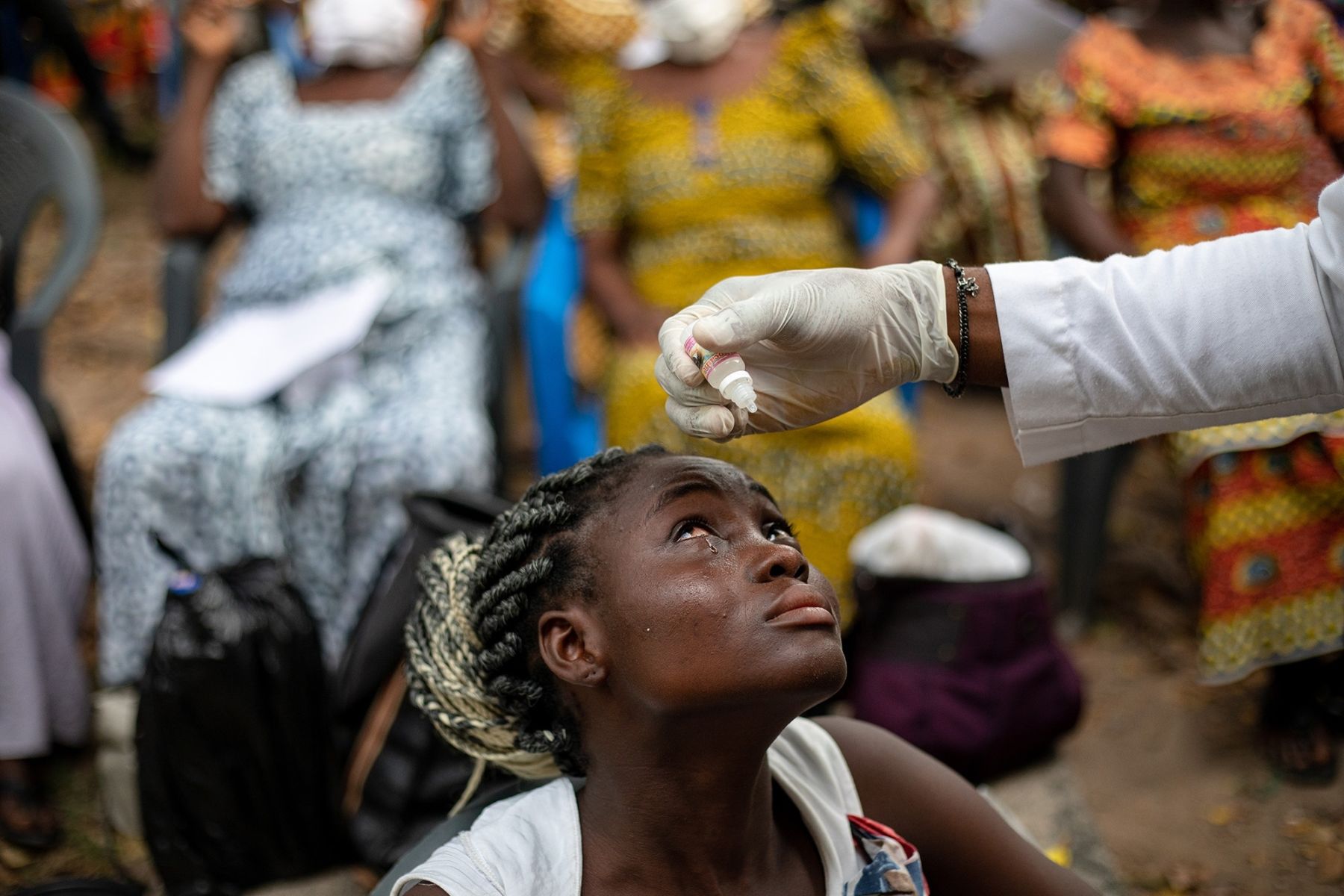 Ghana Patient2 Ghana Patient2