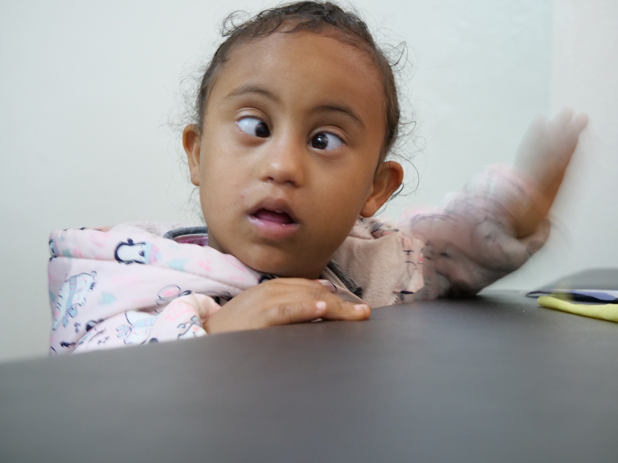 Strabismus: A Curable Condition