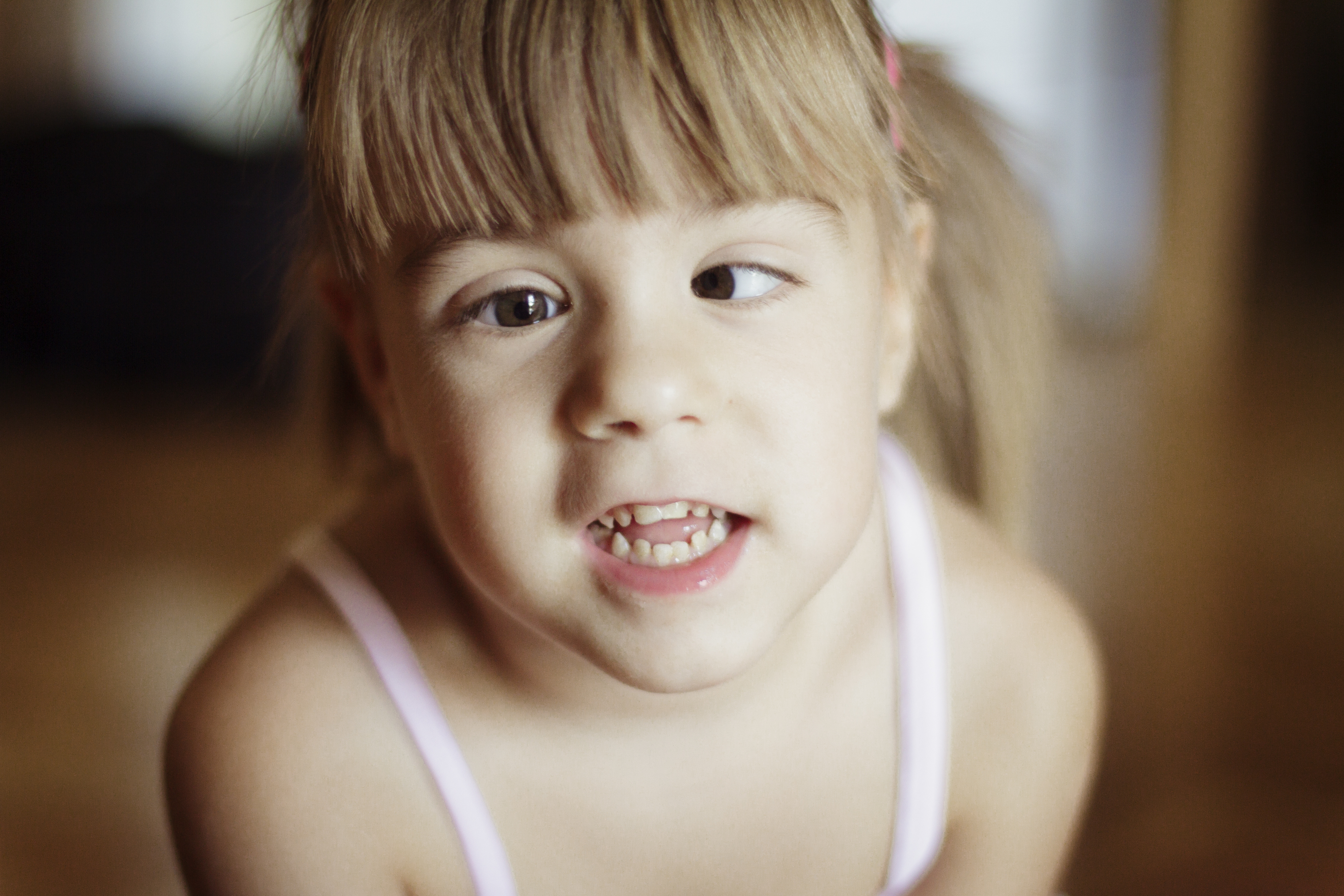 Strabismus: Symptoms, Causes and Treatments